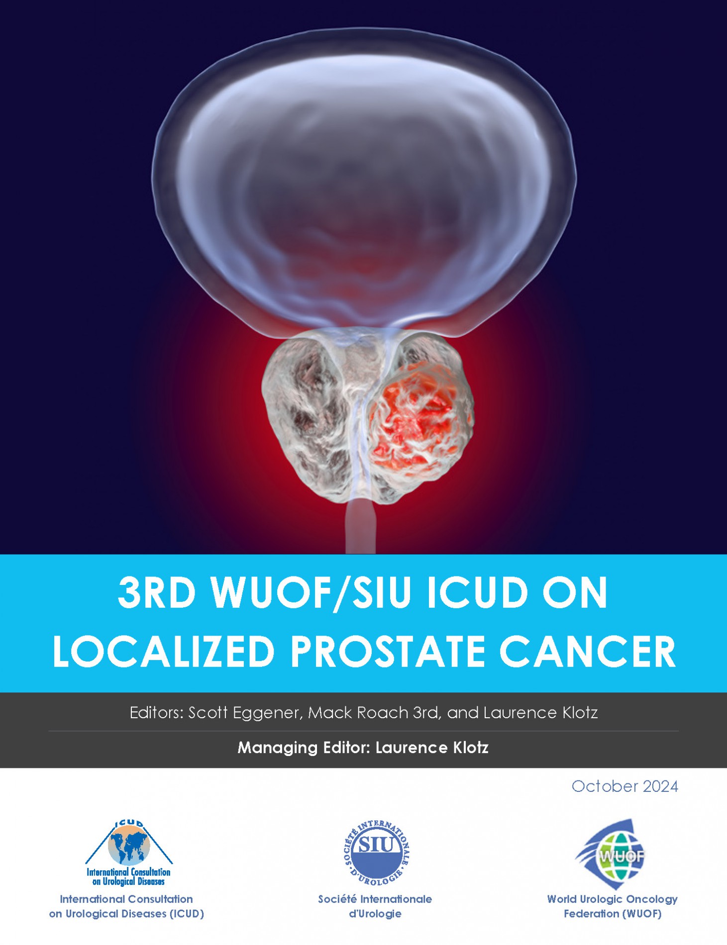 3rd WOUF/SIU ICUD on Localized Prostate Cancer